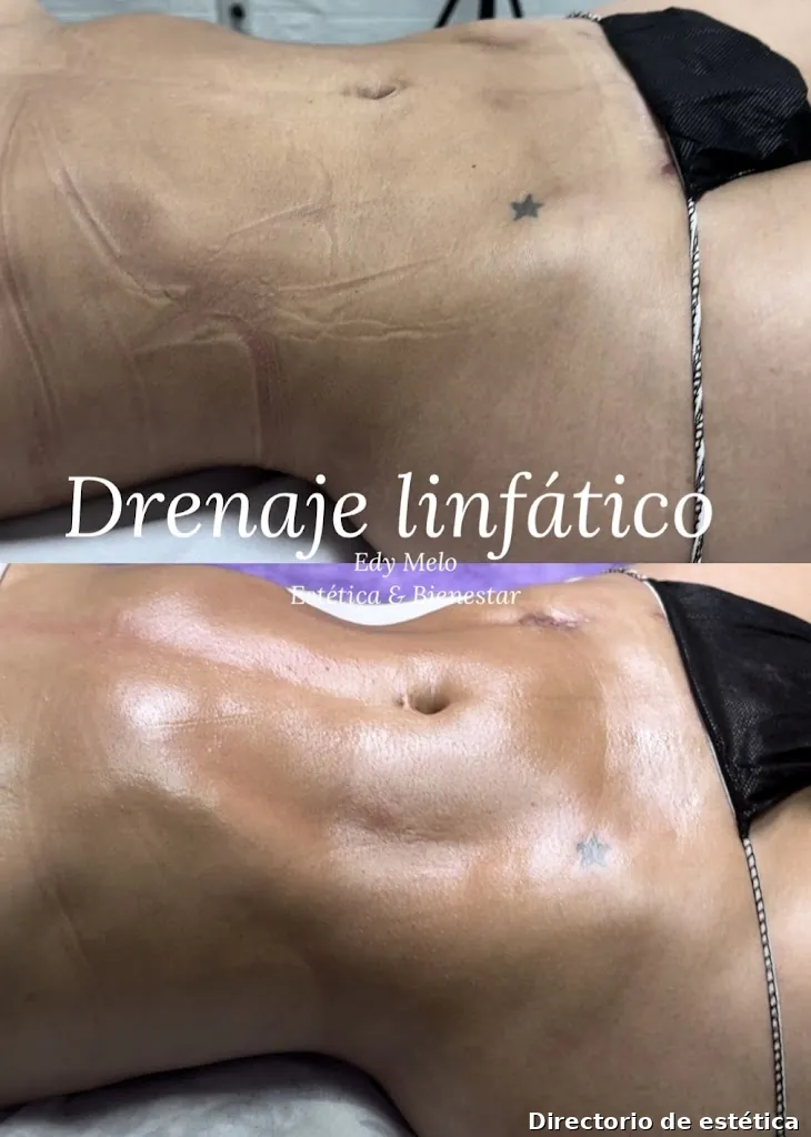Edy Melo Estética & Bienestar