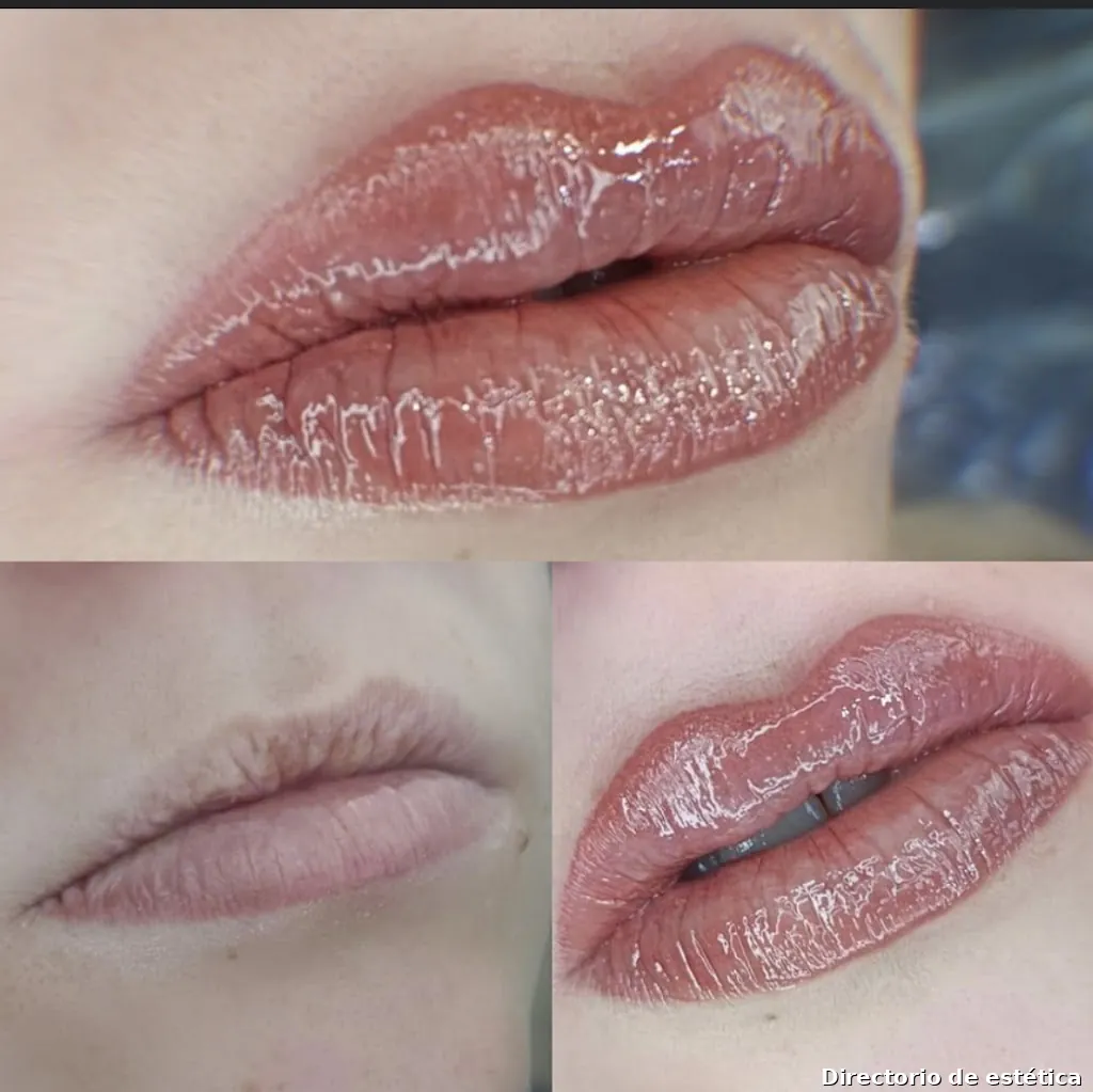 Centro de estética Francis